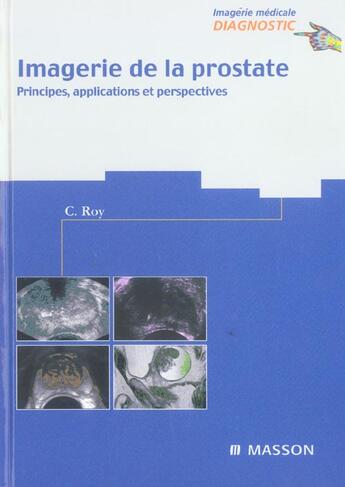 Couverture du livre « Imagerie de la prostate - principes, applications et perspectives » de Catherine Roy aux éditions Elsevier-masson