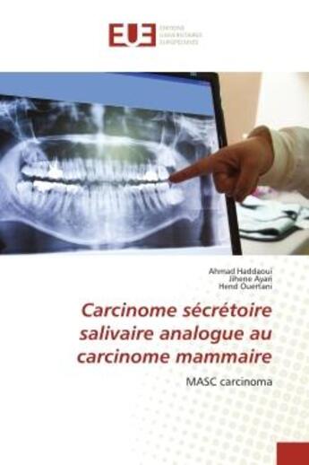 Couverture du livre « Carcinome secretoire salivaire analogue au carcinome mammaire - masc carcinoma » de Haddaoui/Ayari aux éditions Editions Universitaires Europeennes