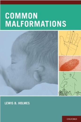 Couverture du livre « Common Malformations » de Holmes Lewis B aux éditions Oxford University Press Usa