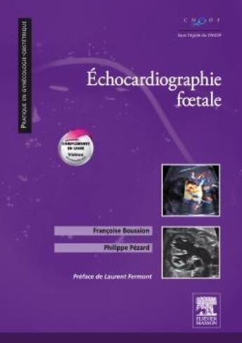 Couverture du livre « Échocardiographie foetale » de Francoise Boussion et Philippe Pezard aux éditions Elsevier-masson