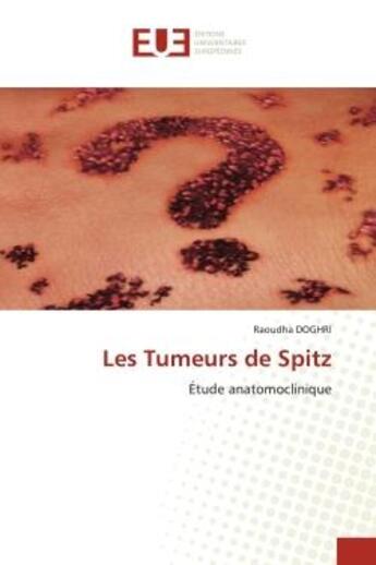 Couverture du livre « Les tumeurs de spitz - etude anatomoclinique » de Doghri Raoudha aux éditions Editions Universitaires Europeennes