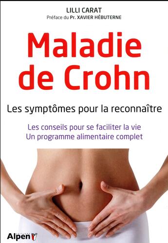 Couverture du livre « Maladie de crohn - les symptomes pour la reconnaitre » de Carat/Hebuterne aux éditions Alpen