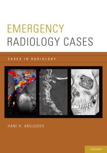 Couverture du livre « Emergency Radiology Cases » de Hani H Abujudeh aux éditions Oxford University Press Usa