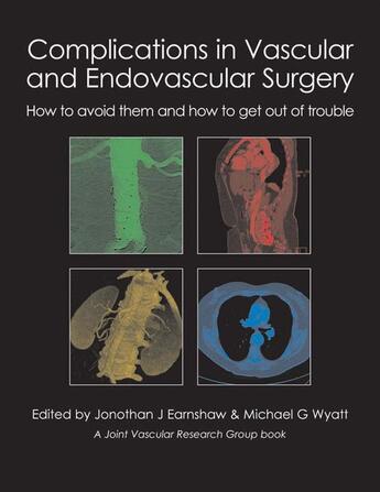 Couverture du livre « Complications in Vascular and Endovascular Surgery » de Jonothan Earnshaw et Michael Wyatt aux éditions Tfm Publishing Ltd