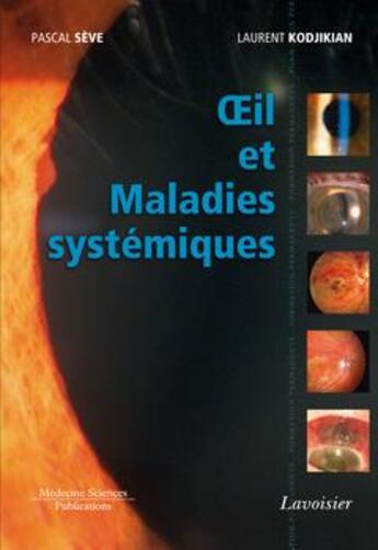 Couverture du livre « Oeil et maladies systémiques » de Pascal Seve et Laurent Kodjikian aux éditions Lavoisier Medecine Sciences
