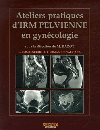Couverture du livre « Ateliers pratiques d irm pelvienne en gynecologie » de Thomassin-Naggara aux éditions Sauramps Medical