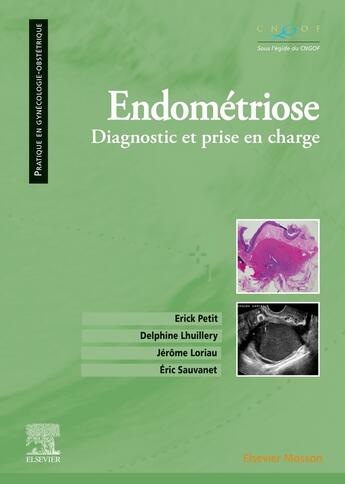 Couverture du livre « Endométriose ; diagnostic et prise en charge » de Erick Petit et Delphine Lhuillery et Eric Sauvanet et Jerome Loriau aux éditions Elsevier-masson