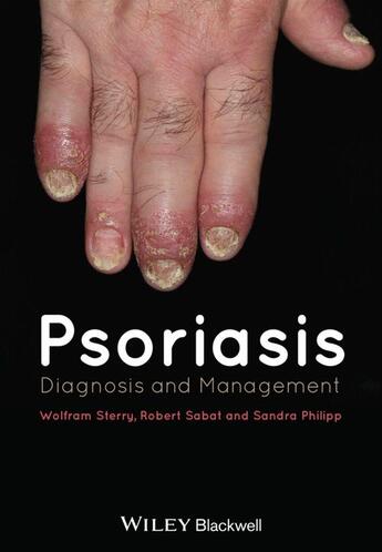 Couverture du livre « Psoriasis » de Wolfram Sterry et Robert Sabat et Sandra Philipp aux éditions Wiley-blackwell