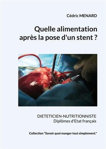 Couverture du livre « Quelle alimentation après la pose d'un stent ? » de Cedric Menard aux éditions Books On Demand