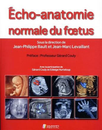 Couverture du livre « Écho-anatomie normale du foetus » de Jean-Marc Levaillant et Collectif et Jean-Philippe Bault aux éditions Sauramps Medical