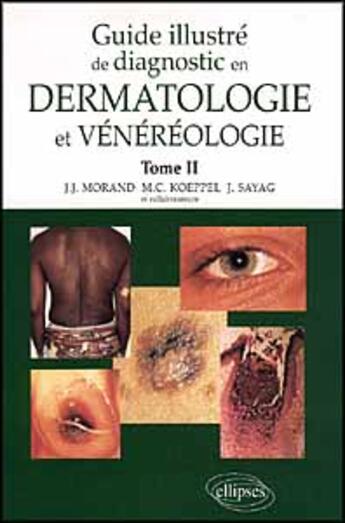 Couverture du livre « Guide illustre de diagnostic en dermatologie et venereologie - tome 2 » de Morand/Koeppel/Sayag aux éditions Ellipses