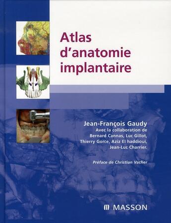 Couverture du livre « Atlas d'anatomie implantaire » de Jean-Francois Gaudy aux éditions Elsevier-masson