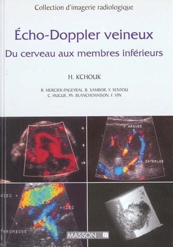 Couverture du livre « Echo-doppler veineux » de  aux éditions Elsevier-masson