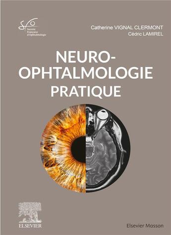 Couverture du livre « Neuro-ophtalmologie pratique » de Catherine Vignal Clermont et Cedric Lamirel aux éditions Elsevier-masson