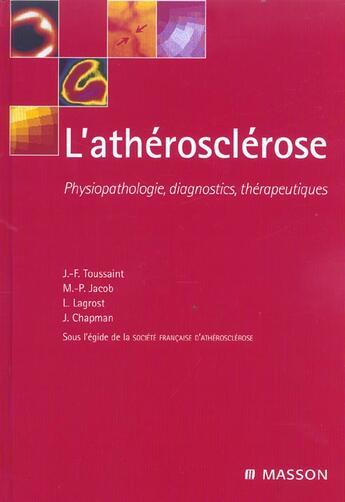 Couverture du livre « L'atherosclerose - physiopathologie, diagnostics et therapeutiques » de Toussaint/Jacob aux éditions Elsevier-masson