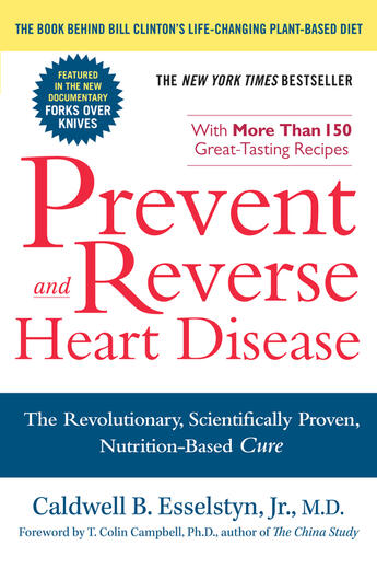 Couverture du livre « Prevent and Reverse Heart Disease » de Esselstyn Caldwell B aux éditions Penguin Group Us