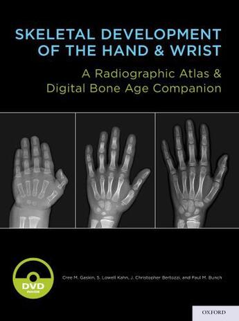 Couverture du livre « Skeletal Development of the Hand and Wrist: A Radiographic Atlas and D » de Bunch Paul M aux éditions Oxford University Press Usa