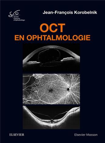 Couverture du livre « OCT en ophtalmologie » de Jean-Francois Korobelnik aux éditions Elsevier-masson