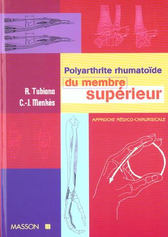 Couverture du livre « Polyarthrite rhumatoide du membre superieur ; approche medico-chirurgicale » de Raoul Tubiana et Charles-Joeel Menkes aux éditions Elsevier-masson