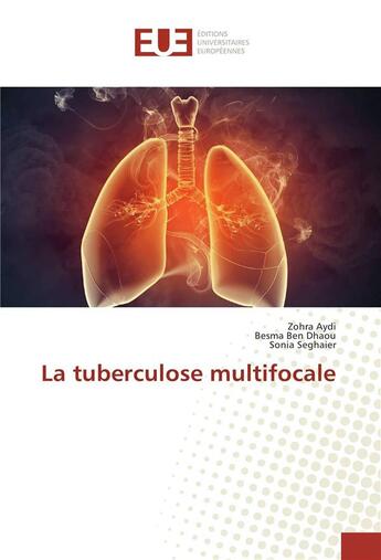 Couverture du livre « La tuberculose multifocale » de Aydi Zohra aux éditions Editions Universitaires Europeennes