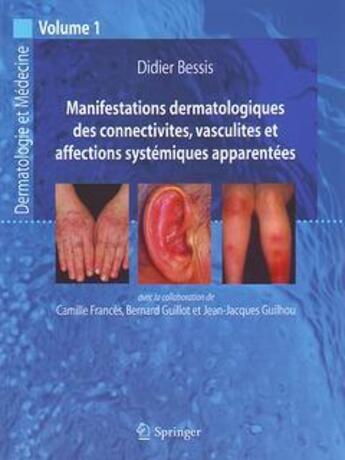 Couverture du livre « Manifestations dermatologiques de collectivites, vasculites et affections systémiques apparentées » de  aux éditions Springer