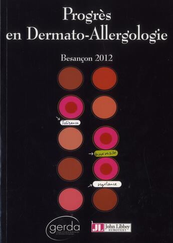 Couverture du livre « Progrès en dermato-allergologie : Besançon 2012 : 33e cours d'actualisation » de Martine Vigan aux éditions John Libbey