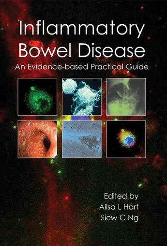 Couverture du livre « Inflammatory Bowel Disease » de Siew Ng Ailsa Hart aux éditions Tfm Publishing Ltd