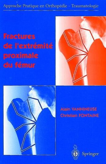 Couverture du livre « Fractures de l'extrémité proximale du fémur » de Alain Vannineuse aux éditions Springer