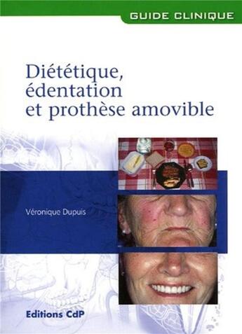 Couverture du livre « Diététique, édentation et prothèse amovible » de Veronique Dupuis aux éditions Cahiers De Protheses