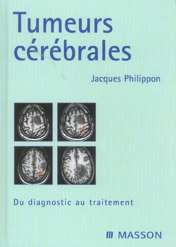 Couverture du livre « Tumeurs cerebrales - du diagnostic au traitement » de Philippon Jacques aux éditions Elsevier-masson