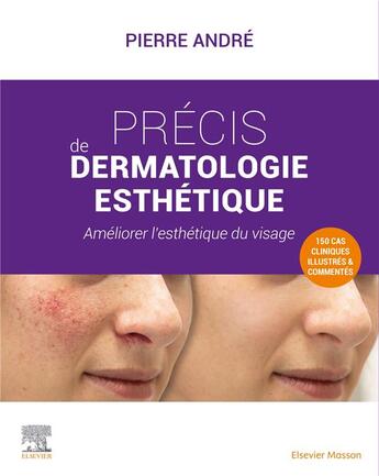 Couverture du livre « Précis de dermatologie esthétique : améliorer l'esthétique du visage » de Pierre Andre aux éditions Elsevier-masson