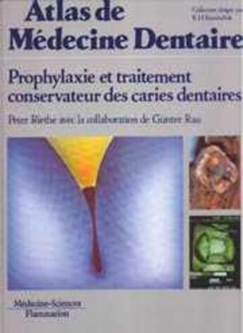 Couverture du livre « Prophylaxie et traitement conservateur des caries dentaires (coll. atlas de medecine dentaire) » de Riethe Peter aux éditions Lavoisier Medecine Sciences