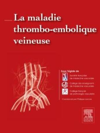 Couverture du livre « La maladie thromboembolique veineuse » de Philippe Lacroix et . Collectif aux éditions Elsevier-masson