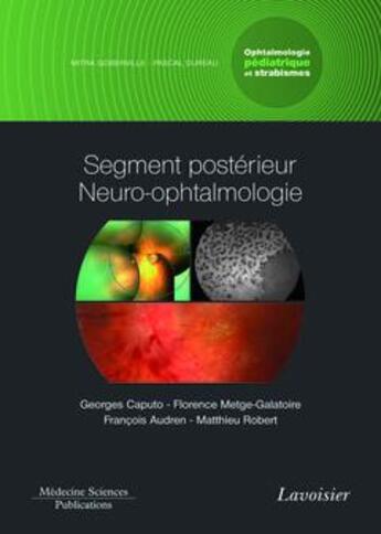 Couverture du livre « Ophtalmologie pédiatrique et strabismes Tome 3 ; segment postérieur neuro-ophtalmologie » de Georges Caputo et Matthieu Robert et Florence Metge-Galatoire et Francois Audren aux éditions Lavoisier Medecine Sciences