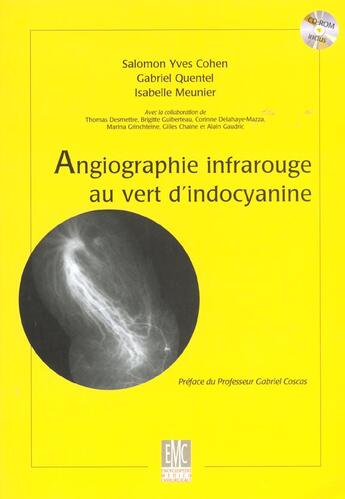 Couverture du livre « Angiographie infrarouge au vert d'indocyanine » de Isabelle Meunier et Salomon-Yves Cohen et Gabriel Quentel aux éditions Elsevier-masson