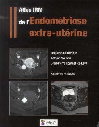 Couverture du livre « Atlas IRM de l'endométriose extra-utérine » de Benjamin Dallaudiere et Antoine Maubon et Jean-Pierre Rouanet De Lavit aux éditions Sauramps Medical