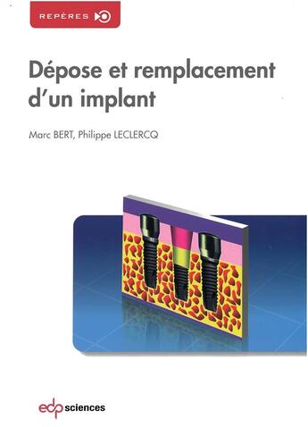 Couverture du livre « Dépose et remplacement d'un implant » de Philippe Leclercq et Marc Bert aux éditions Parresia