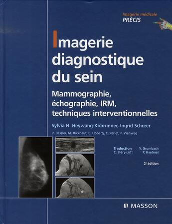 Couverture du livre « Imagerie diagnostique du sein ; mammographie, échographie, irm, techniques interventionnelles » de Heywang et Kobrunner et Scheer aux éditions Elsevier-masson