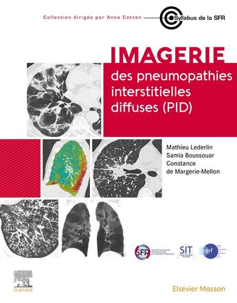 Couverture du livre « Imagerie des pneumopathies interstitielles diffuses (PID) » de Constance De Margerie-Mellon et Mathieu Lederlin et Samia Boussouar aux éditions Elsevier-masson