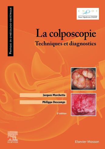 Couverture du livre « La colposcopie : Techniques et diagnostics (5e édition) » de Philippe Descamps et Jacques Marchetta aux éditions Elsevier-masson