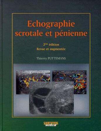 Couverture du livre « Echographie scrotale et penienne » de Puttemans Thierry aux éditions Sauramps Medical