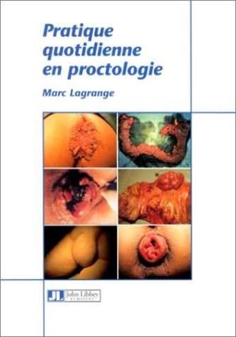 Couverture du livre « Pratique Quotidienne En Proctologie » de M Lagrange aux éditions John Libbey