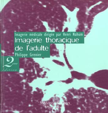 Couverture du livre « Imagerie thoracique de l'adulte (collection imagerie medicale) » de Philippe Grenier aux éditions Lavoisier Medecine Sciences