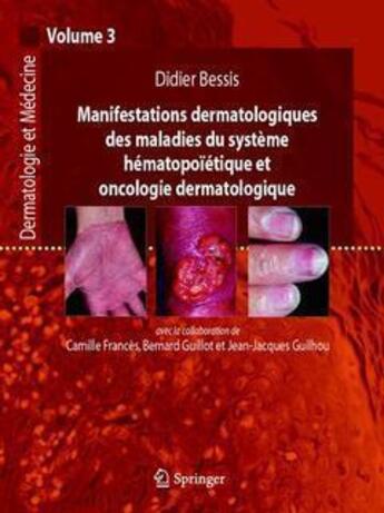 Couverture du livre « Dermatologie et médecine Tome 3 ; manifestations dermatologiques des maladies du système hématopoiétique et oncologie, dermatologique » de Bessis/Frances aux éditions Springer