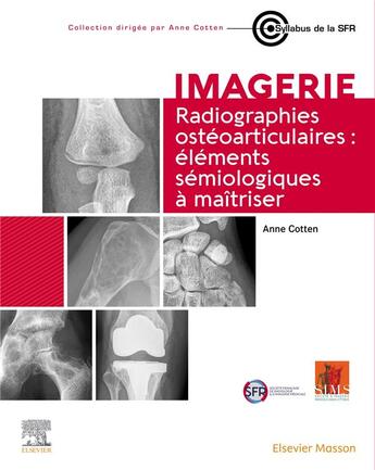 Couverture du livre « Imagerie : radiographies ostéoarticulaires : éléments sémiologiques à maîtriser » de Anne Cotten aux éditions Elsevier-masson