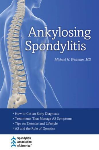 Couverture du livre « Ankylosing Spondylitis » de Weisman Michael H aux éditions Editions Racine