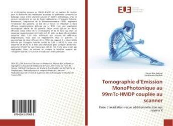 Couverture du livre « Tomographie d'Emission MonoPhotonique au 99mTc-HMDP couplée au scanner » de Dorra Ben Sellem aux éditions Editions Universitaires Europeennes