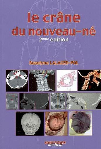 Couverture du livre « Le crâne du nouveau-né (2e édition) » de Lalauze Pol/Ber aux éditions Sauramps Medical