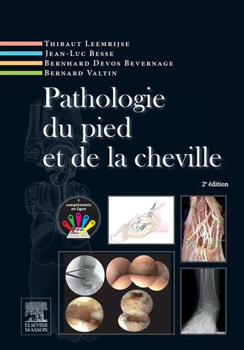 Couverture du livre « Pathologie du pied et de la cheville (2e édition) » de Besse Jean-Luc et Thibaut Leemrijse et Bernhard Devos Bevernage aux éditions Elsevier-masson