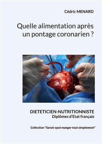 Couverture du livre « Quelle alimentation après un pontage coronarien ? » de Cedric Menard aux éditions Books On Demand